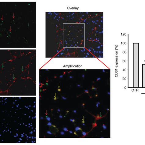 Example Of Immunostaining With Specific Antibodies For α Actin Red