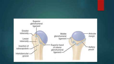 Recurrent Shoulder Dislocation And Management Ppt