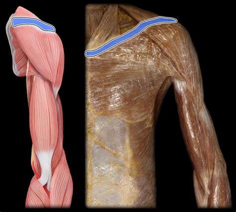 Prelab 8 Muscles Of The Upper Limb Lab Flashcards Quizlet