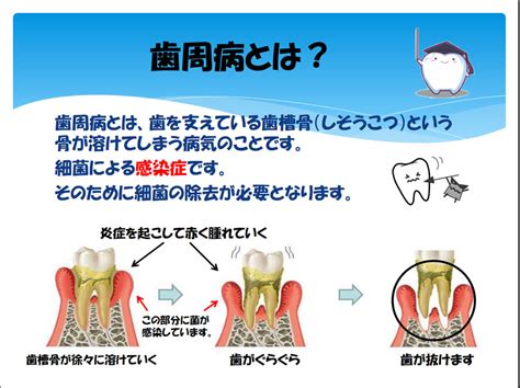 歯周病の治療 丹波市の歯医者、あせい歯科