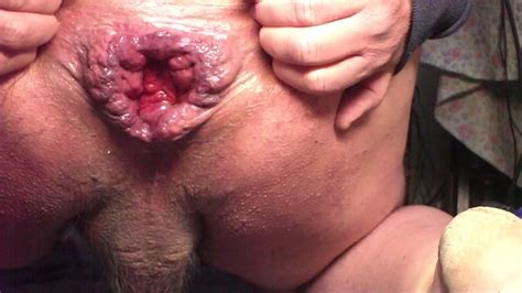 Two Apples Anal Gay Porn XHamster