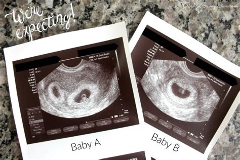 6 Weeks Pregnant With Twins Update - Budget Savvy Diva