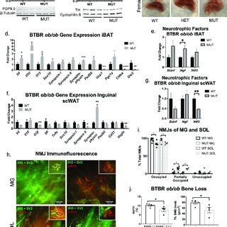 Neuropathy Extends Beyond White Adipose Tissue In Btbr Ob Ob Mice