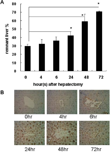 Figure 1 From Il 6 Regulates Mcl 1l Expression Through The Jakpi3kakt