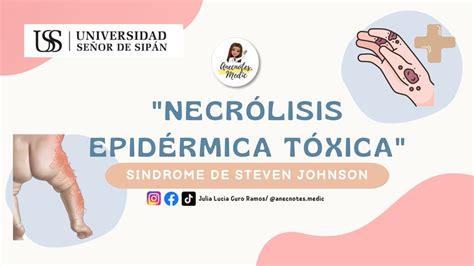 Necrólisis Epidérmica Tóxica Julia Lucia Curo Ramos anecnotes medic