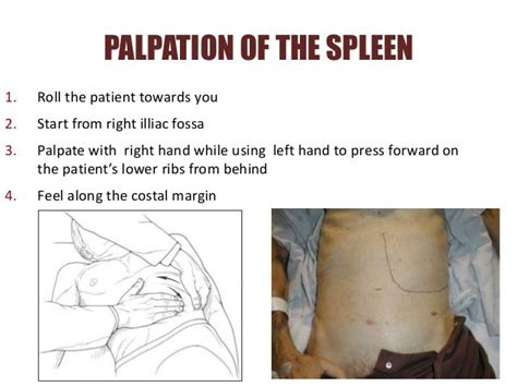 Abdominal Examination