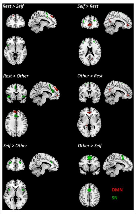 Differences In The Connectivity Of The Dmn And The Sn Between Pairs