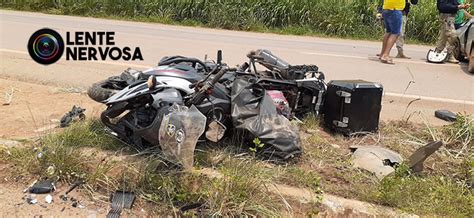 Motoqueiro quebra braço e perna em grave acidente em Candeias do Jamari