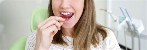 Can You Chew Gum With Invisalign