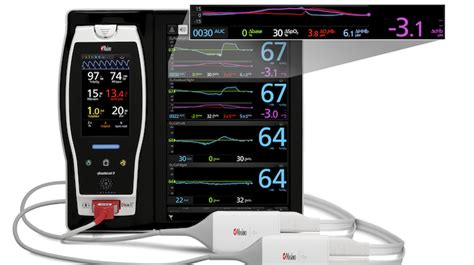 Fda Clears Respiration Rate Measurement For Masimos Home Finger Pulse