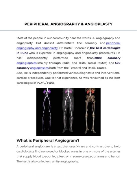 Ppt Peripheral Angiography And Angioplasty Powerpoint Presentation Id