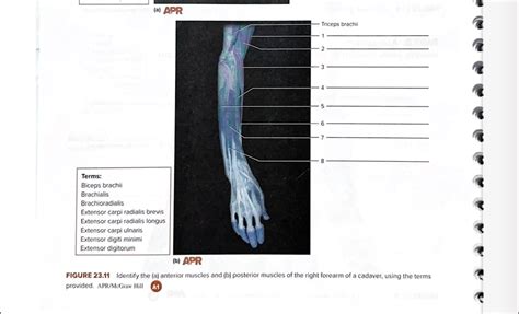 Solved Text A Apr Triceps Brachii Terms Biceps Brachii Brachialis