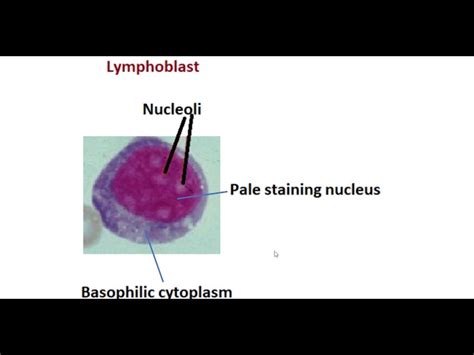 Lymphoblast