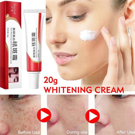 Effective Freckle Removal Whitening Cream Melasma Removal Cream