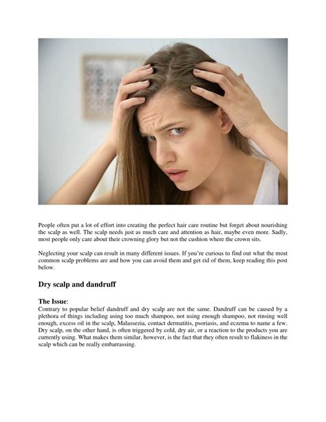 Ppt 3 Common Scalp Problems And How To Get Rid Of Them Powerpoint