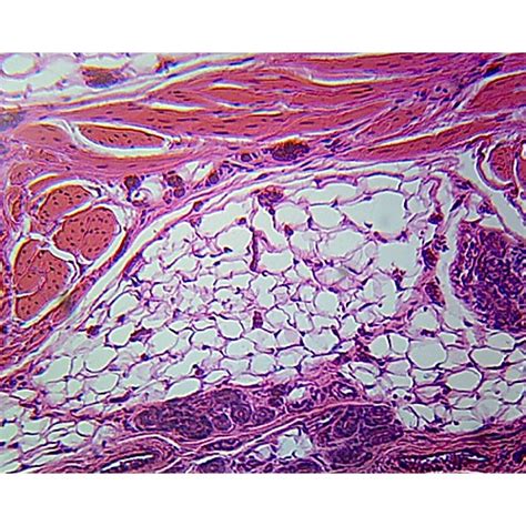 Prepared Microscope Slideintegumentary Tissues Human Skin Cs