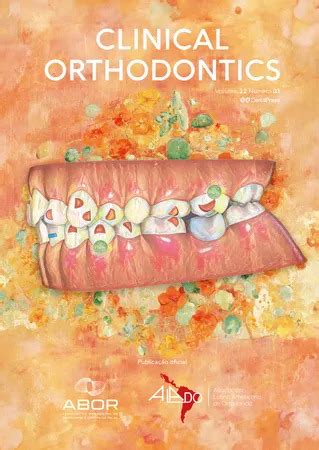 Nova Edi O Da Clinical Orthodontics Revista Cl Nica De Ortodontia