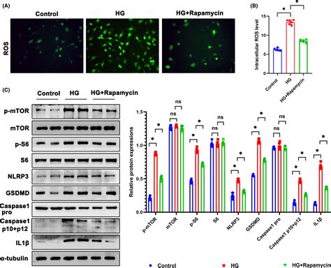 Dihydroxyacetone Phosphate Accumulation Leads To Podocyte Pyroptosis In