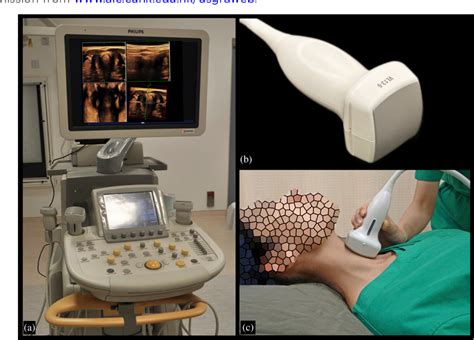 Figure From Multiplanar D Ultrasound Imaging To Assess The Anatomy