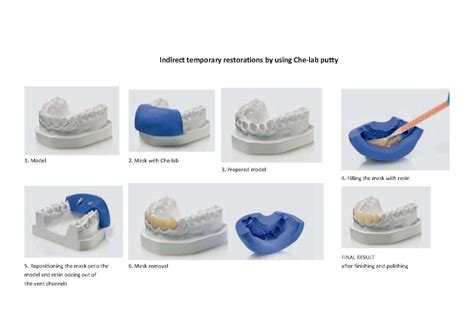 Factory Directly Supply Dental Lab Material Supply Dental Lab Putty