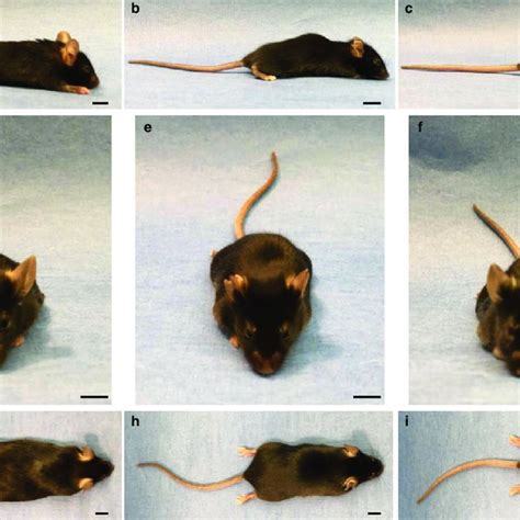 In Utero Base Editing Ameliorates The Facial And Skeletal Abnormalities