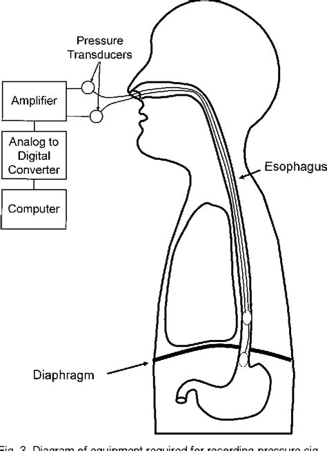 Figure 3 From Esophageal And Gastric Pressure Measurements Semantic