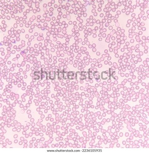 Red Blood Cells Under Microscope Lens Stock Photo 2236105935 | Shutterstock