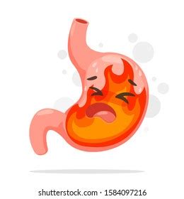 Illustration Acid Reflux Heartburn Cartoon Vector Stock Vector Royalty