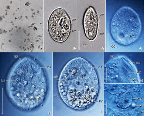 Tetrahymena unionis sp. n. from life. a Overview, showing many cells ...