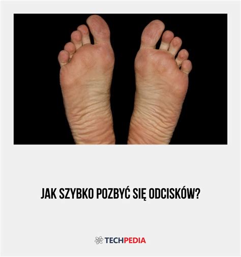 Jak Szybko Pozby Si Odcisk W