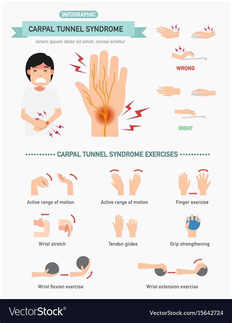 Carpal Tunnel Syndrome Effective Exercises Carpal Tunnel Syndrome