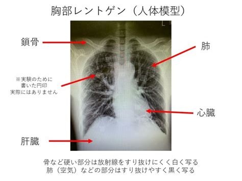 【わかりやすい！】レントゲン検査とは～放射線技師の仕事編～ ねずさんのラジオロジー学習帳