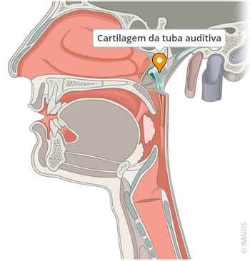 Tuba Auditiva Inflamada - Cartilagem da tuba auditiva - e-Anatomy - IMAIOS