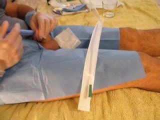 正しいカテーテル挿入手順 Pornhub Gay