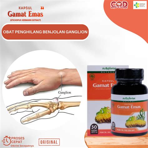 Obat Penghilang Benjolan Ganglion Obat Kista Ganglion Obat Benjolan