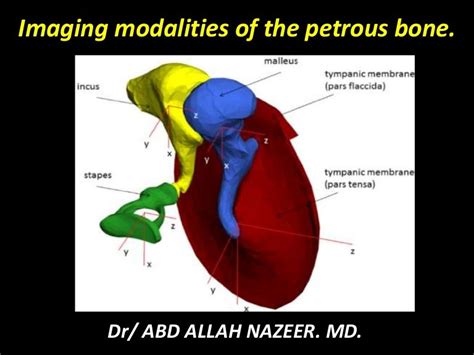 Imaging modalities of the petrous bone