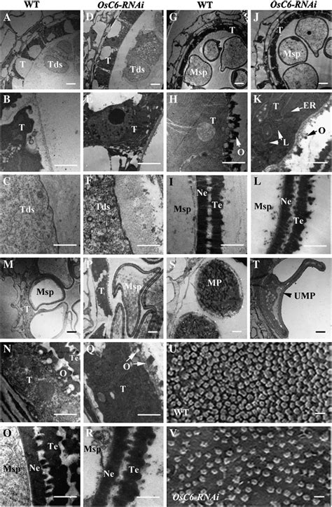 Transmission Electron Micrographs Of Anthers From Wild Type And