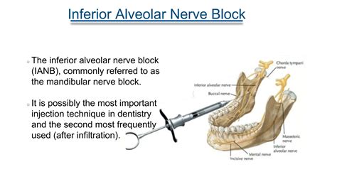 Inferior Alveolar Nerve Block Anesthetic Technique Ppt