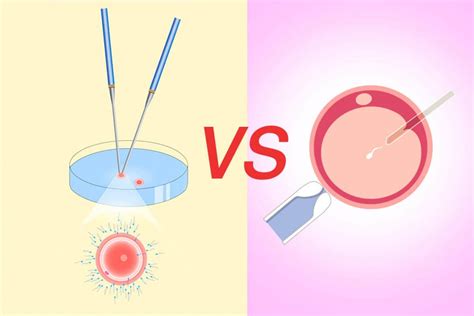 Ivficsi Treatment Ivf In Thailand Leading Fertility