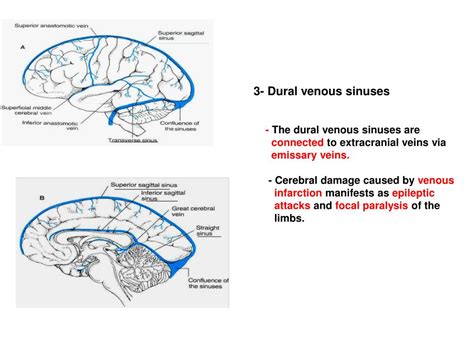 Ppt Blood Supply Of The Brain 1 Internal Carotid Arteries Powerpoint