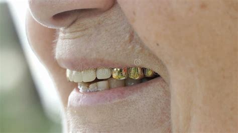 Old Woman Smile Teeth Stock Footage & Videos - 466 Stock Videos