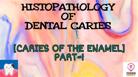 HISTOPATHOLOGY OF DENTAL CARIES CARIES IN THE ENAMEL PART 1 YouTube