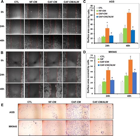 EphA2 Inhibitor Abrogates Cancer Cell Motility Promoted By CAF CM