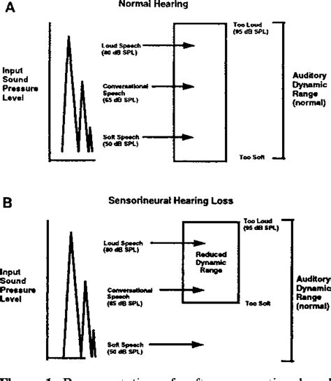 Figure 1 From Theoretical And Practical Considerations In Compression Hearing Aids Semantic