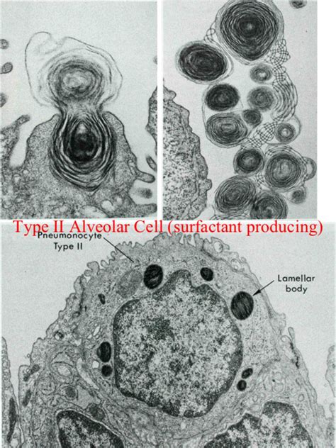 Type Ii Alveolar Cell