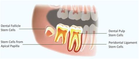 3 Things You Need To Know About Dental Stem Cells - Health changing