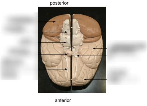 Human Brian Inferior View Diagram Quizlet