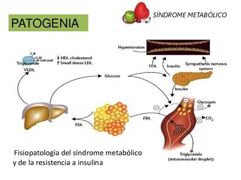 Síndrome Metabólico