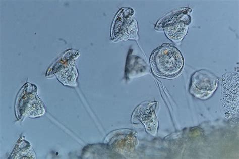 Vorticella campanula • Think smart, think eSHa!