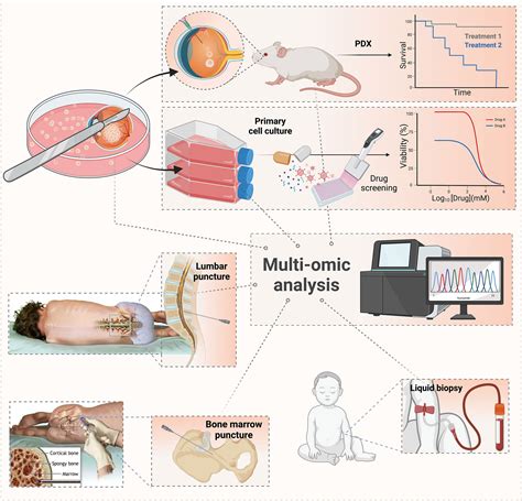 Frontiers Treatment Of Retinoblastoma What Is The Latest And What Is The Future